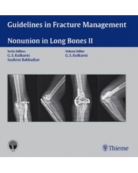 Guidelines in Fracture Management-Nonunion in Long Bones II